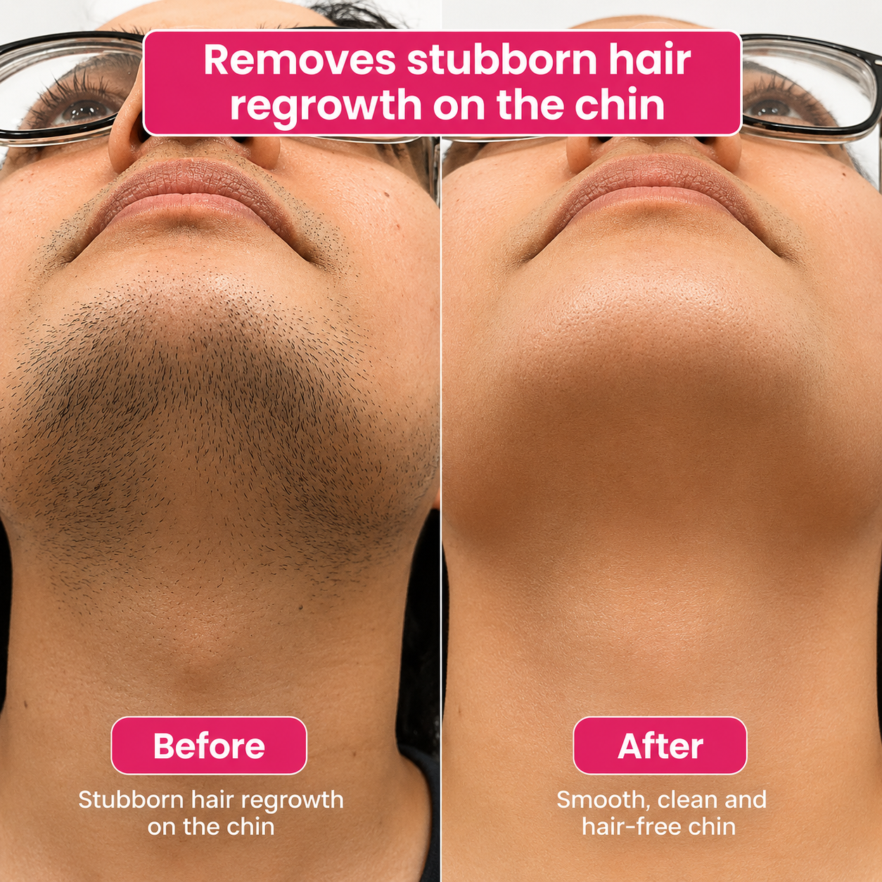 🔥LAST DAY 60% OFF Mintsora Hair Reduction Oil 60 ml – Permanent Hair Removal Oil