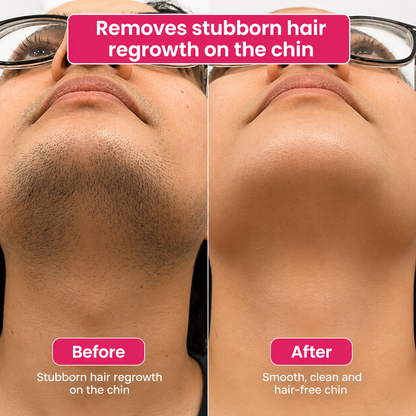 🔥LAST DAY 60% OFF  Mintsora Hair Reduction Oil 60 ml – Permanent Hair Removal Oil